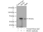 PKM2 Antibody in Immunoprecipitation (IP)