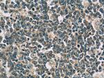 IL-28A Antibody in Immunohistochemistry (Paraffin) (IHC (P))