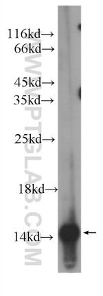 FABP3 Antibody in Western Blot (WB)