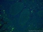 IL36 beta/IL1F8 Antibody in Immunohistochemistry (PFA fixed) (IHC (PFA))