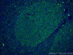 IL36 beta/IL1F8 Antibody in Immunohistochemistry (PFA fixed) (IHC (PFA))