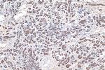 TNF alpha Antibody in Immunohistochemistry (Paraffin) (IHC (P))