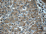 TNF alpha Antibody in Immunohistochemistry (Paraffin) (IHC (P))