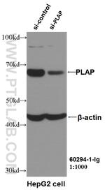 PLAP Antibody in Western Blot (WB)