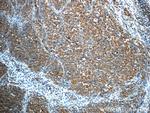 ALK/CD246 Antibody in Immunohistochemistry (Paraffin) (IHC (P))