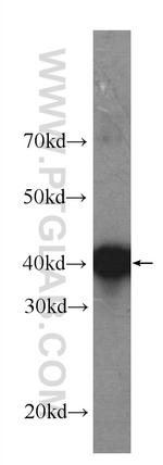 ALK/CD246 Antibody in Western Blot (WB)