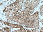 TNFAIP1 Antibody in Immunohistochemistry (Paraffin) (IHC (P))