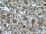 TNFAIP1 Antibody in Immunohistochemistry (Paraffin) (IHC (P))