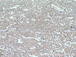 TNFAIP1 Antibody in Immunohistochemistry (Paraffin) (IHC (P))