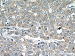 TNFAIP1 Antibody in Immunohistochemistry (Paraffin) (IHC (P))