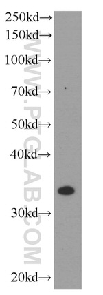 TNFAIP1 Antibody in Western Blot (WB)