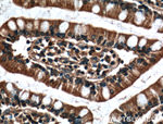 CX3CL1 Antibody in Immunohistochemistry (Paraffin) (IHC (P))