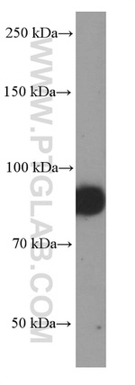 MUM1 Antibody in Western Blot (WB)