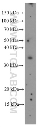 TIM3 Antibody in Western Blot (WB)