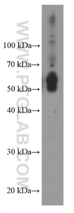 TIM3 Antibody in Western Blot (WB)