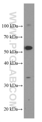 TIM3 Antibody in Western Blot (WB)