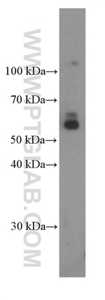 TIM3 Antibody in Western Blot (WB)