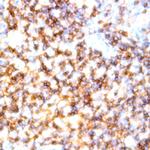 CD10 Antibody in Immunohistochemistry (Paraffin) (IHC (P))