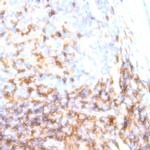 HLA-DR Antibody in Immunohistochemistry (Paraffin) (IHC (P))