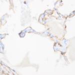 Nix Antibody in Immunohistochemistry (Paraffin) (IHC (P))