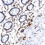 PIN-1 Antibody in Immunohistochemistry (Paraffin) (IHC (P))