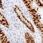 STAT5 Antibody in Immunohistochemistry (Paraffin) (IHC (P))