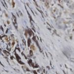 Tyrosinase Antibody in Immunohistochemistry (Paraffin) (IHC (P))