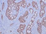 ROS1 Antibody in Immunohistochemistry (Paraffin) (IHC (P))