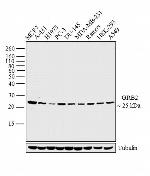 Goat IgG (H+L) Secondary Antibody in Western Blot (WB)