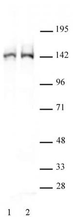 FancD2 Antibody in Western Blot (WB)