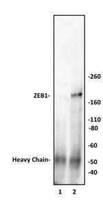 ZEB1 Antibody in Immunoprecipitation (IP)