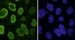 Histone macroH2A1.2 Antibody in Immunocytochemistry (ICC/IF)