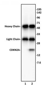 CDKN2A Antibody in Immunoprecipitation (IP)