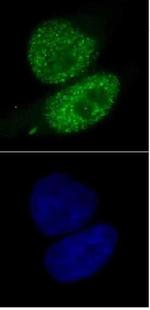 SMARCA4 Antibody in Immunocytochemistry (ICC/IF)