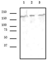 SMARCA4 Antibody in Western Blot (WB)