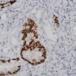 TTK Antibody in Immunohistochemistry (Paraffin) (IHC (P))