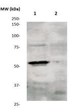 Phospho-TGFBR1 (Ser165) Antibody in Western Blot (WB)