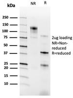 RXRG/NR2B3 (Transcription Factor) Antibody in SDS-PAGE (SDS-PAGE)