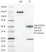 S100A1 Antibody in SDS-PAGE (SDS-PAGE)