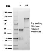 S100A1 (Melanoma Marker) Antibody in SDS-PAGE (SDS-PAGE)