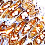 ZO-1 Antibody in Immunohistochemistry (Paraffin) (IHC (P))