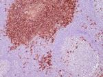 CD138/Syndecan-1 (SDC1) (Plasma Cell Marker) Antibody in Immunohistochemistry (Paraffin) (IHC (P))