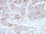 CD138/Syndecan-1 (SDC1) (Plasma Cell Marker) Antibody in Immunohistochemistry (Paraffin) (IHC (P))