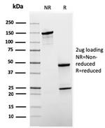 Sex Hormone Binding Globulin (SHBG) Antibody in SDS-PAGE (SDS-PAGE)