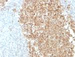 CDw75 (B-Cell Marker) Antibody in Immunohistochemistry (Paraffin) (IHC (P))