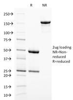 gp100/Melanosome/PMEL17/SILV Antibody in SDS-PAGE (SDS-PAGE)