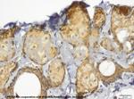 TIP47/PLIN3 Antibody in Immunohistochemistry (IHC)