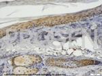 TIP47/PLIN3 Antibody in Immunohistochemistry (IHC)