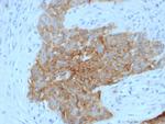 GLUT-1 Antibody in Immunohistochemistry (Paraffin) (IHC (P))