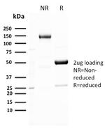 GLUT-1 Antibody in SDS-PAGE (SDS-PAGE)